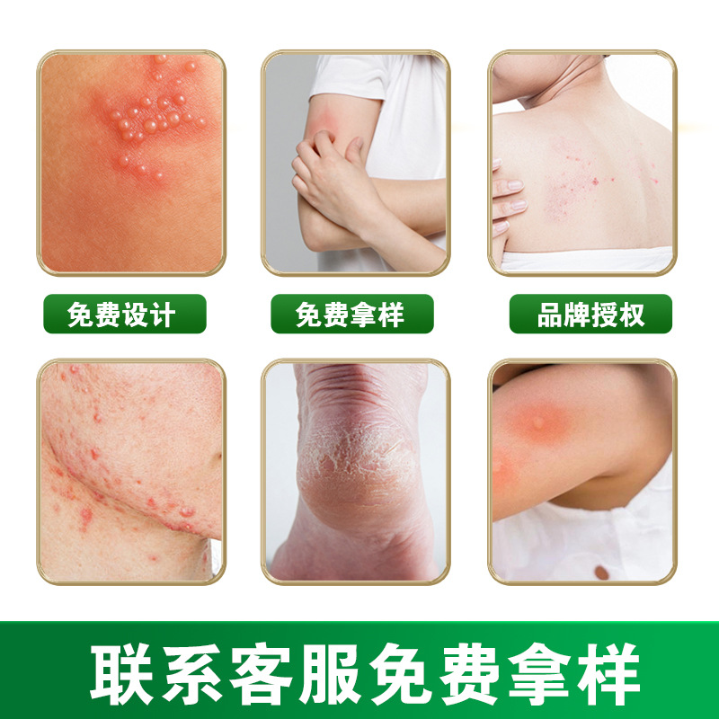 Yunnan Herbal Itch Relief Cream Yao Benren Skin Ointment 20g External Use - Image 2