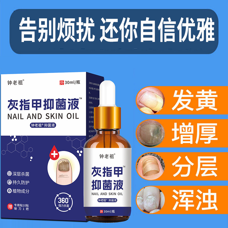 Plant Extract Nail and Foot Care Liquid Gel Cream Spray Ointment External Herbal Care - Image 2