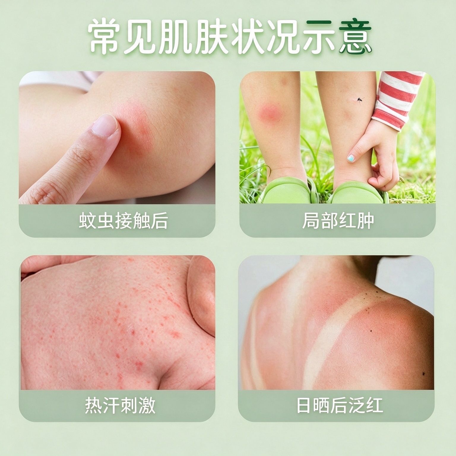 Zicao Herbal Balm 30ml Mugwort Ai Ye Ointment for External Soothing Care - Image 3