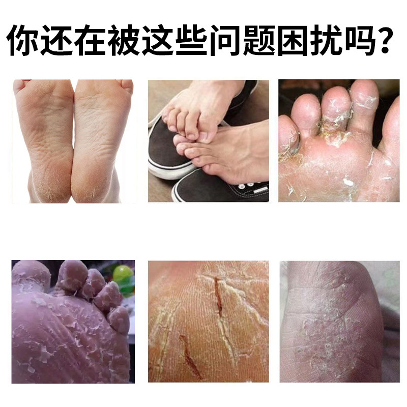 Wang Lang Du Ointment Foot Care External Herbal Balm 20g - Image 2