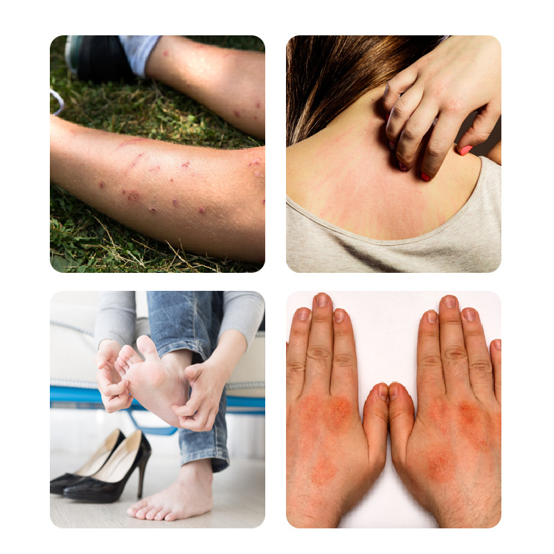 Qi Du Pi Xuan Kang Antibacterial Spray and Cream for Foot Odor and Itching External Use 60ml Plus 20g - Image 2