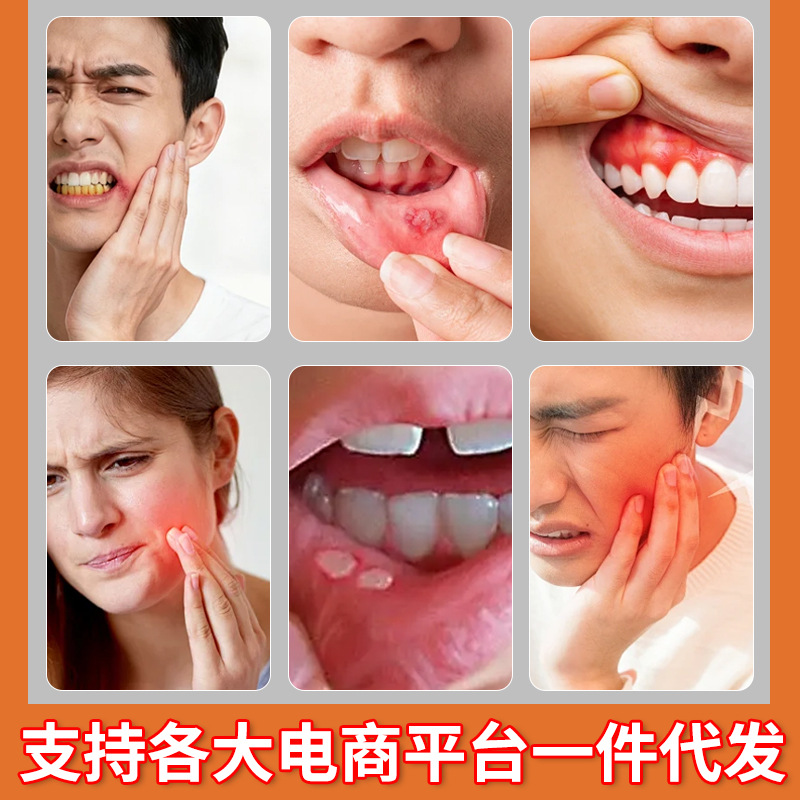 Yao Benren Medical Oral Ulcer Care Spray 25ml Adult Oral Care Liquid - Image 2