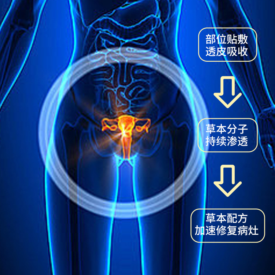 Prostate Care Herbal Patch with Nanyang Mugwort Acupoint Patch 8 Patches per Box - Image 2