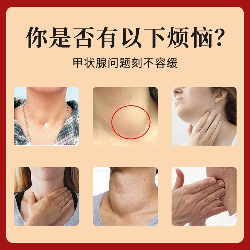 Thyroid Care Cream Neck Massage Cream 30g External Application for Wellness Massage - Image 2