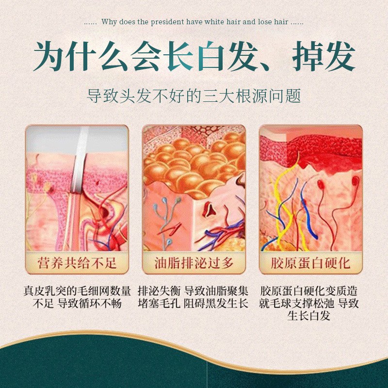 He Shou Wu Ce Bai Ye Herbal Shampoo 500ml Scalp Care Oil Control Hair Cleanser for Men and Women - Image 4