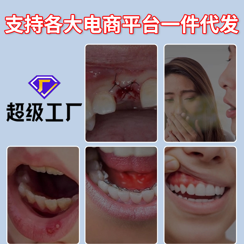 Medical Oral Ulcer Care Spray 25ml Mouth Inflammation Relief Adult Oral Care - Image 2