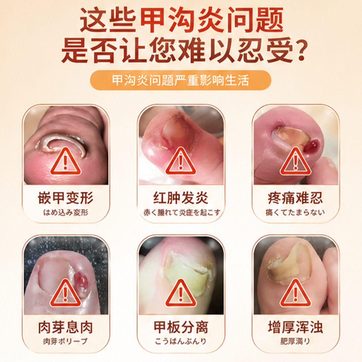 Juguantang Jiagou Baicao Foot Care Herbal Massage Cream 50g Topical Nail Area Comfort Balm - Image 4