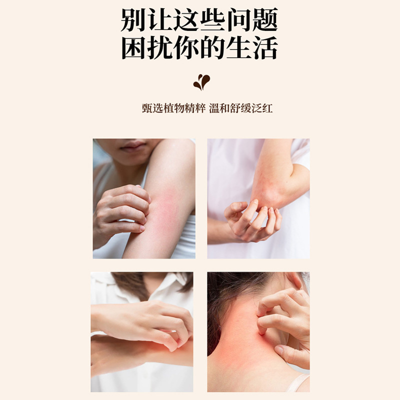 Ma Huang Lian Qiao Anti-Itch Herbal Balm 30g External Skin Care Soothing Body Balm - Image 2