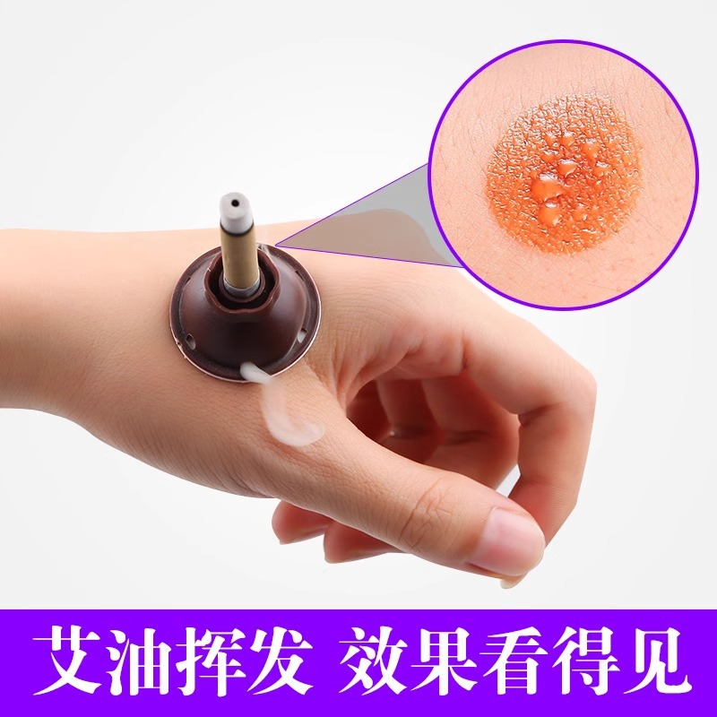 Moxa Stick Cones Ai Zhu 艾柱 Smokeless Moxibustion Sticks 6.8x35mm 60 Count Portable Home Use - Image 4