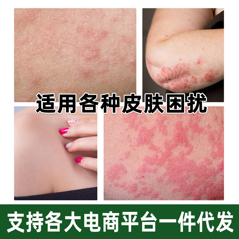 Thai Itch Relief Ointment External Skin Balm 20g Traditional Herbal Topical for Neck Area - Image 2