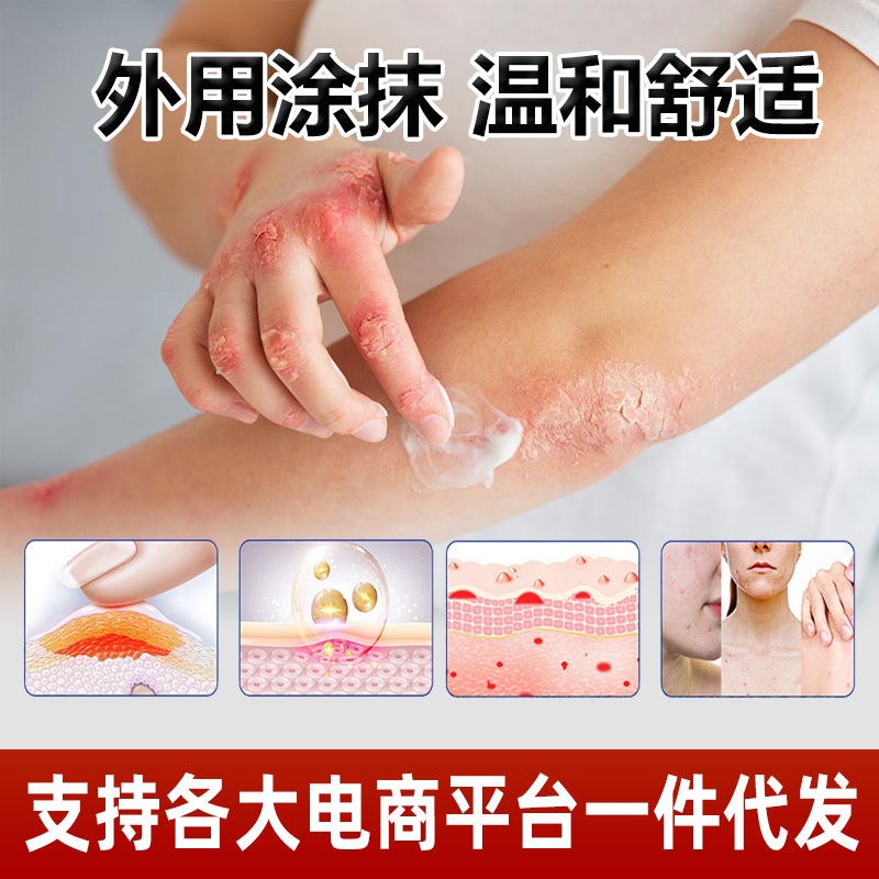 Shennong Baiyang Wang Herbal Ointment 20g External Topical Balm for Traditional Herbal Care - Image 2